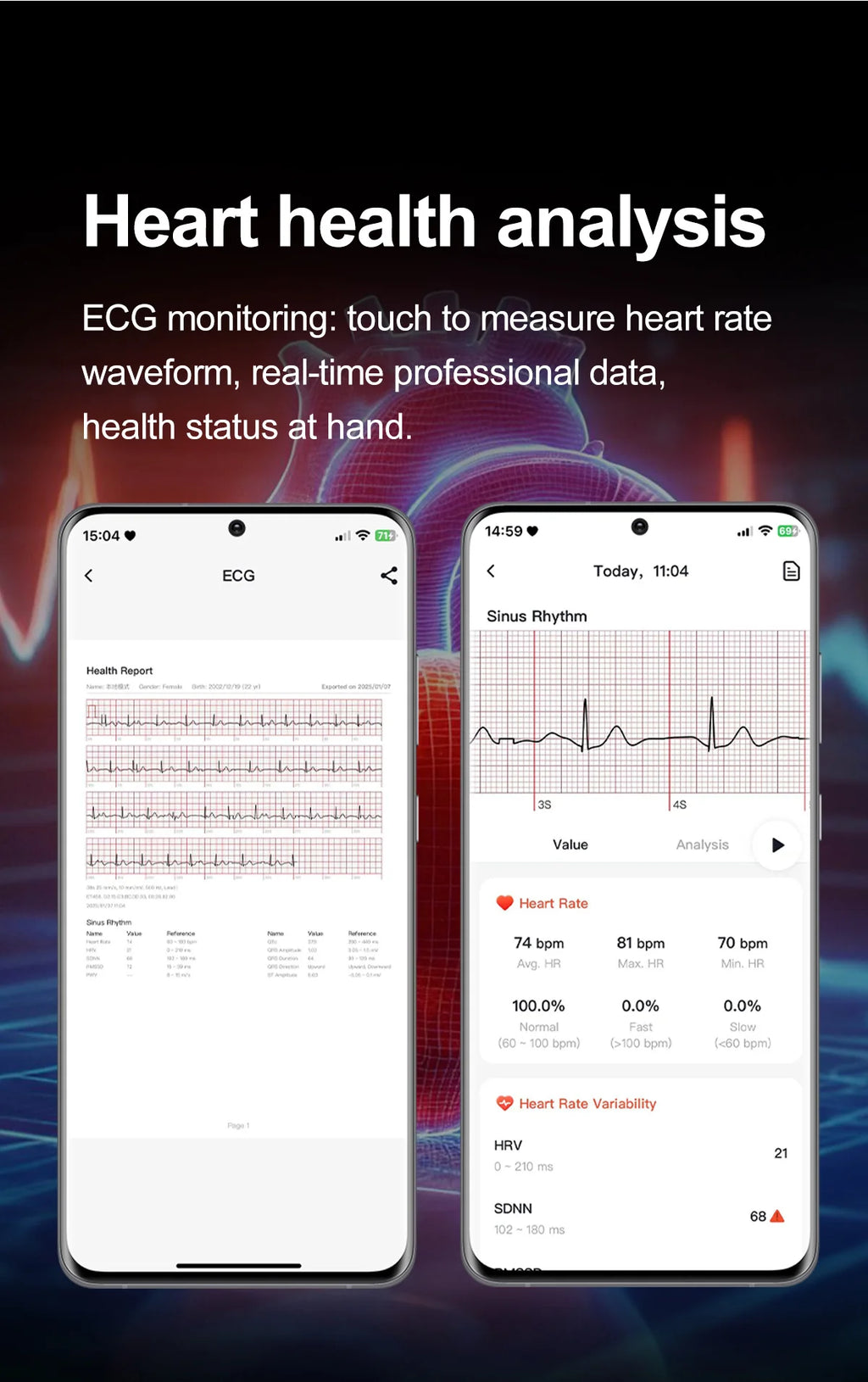 NovaPulse™ Health Smart Watch