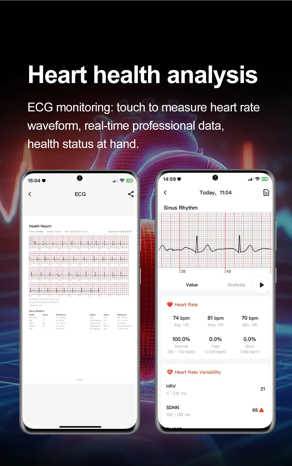 NovaPulse™ Health Smart Watch